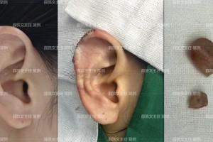 解封之后，经济复苏的疤痕效应与韧性生长
