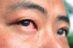 2019年疫情，一场由新型冠状病毒引发的全球风暴