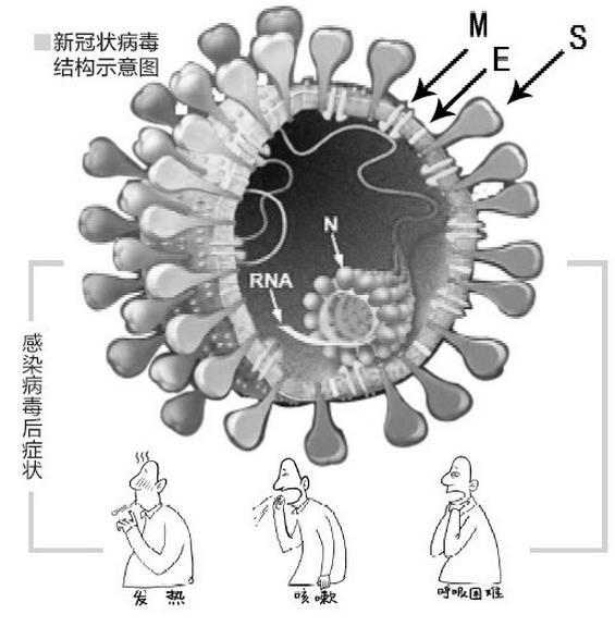 疫情病毒叫什么,有什么症状表现