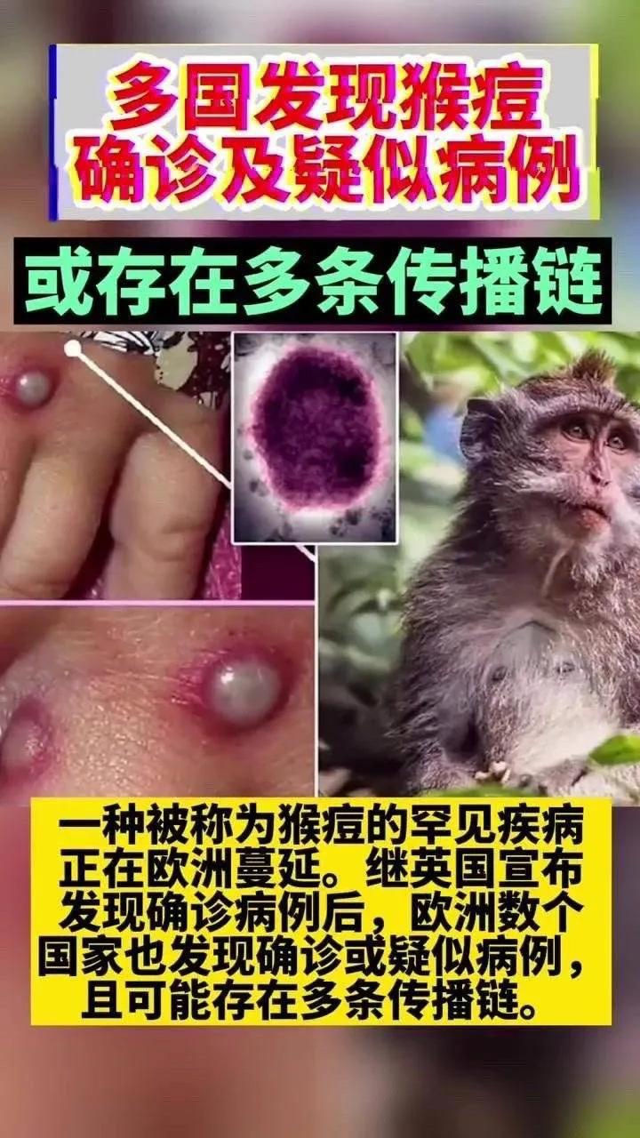 新冠病毒，一场全球大流行的始末与影响